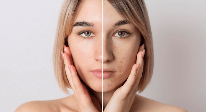 5 surprising ingredients for healthy looking skin picture